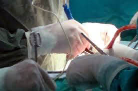 opertaie