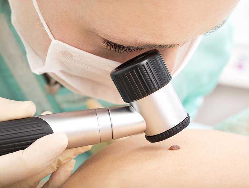 dermatologie