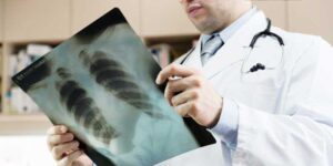 radiografie_pulmonara_riscuri646